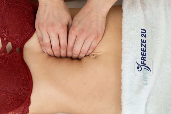 diastasis recti treatment Borehamwood