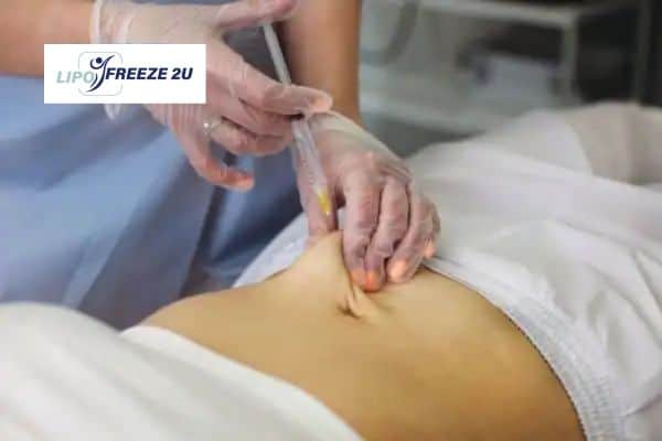 Fat Dissolving Injections Borehamwood & Weight loss medication