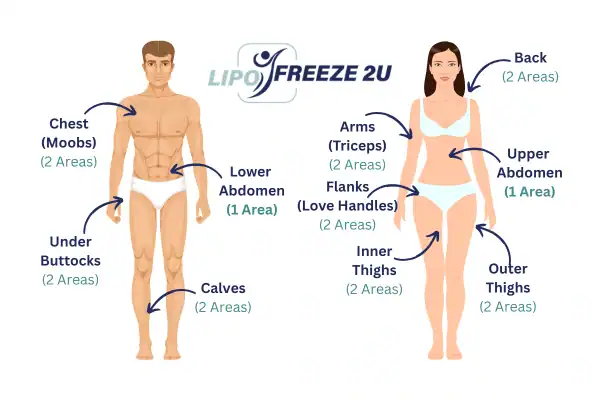 Areas you can have fat freezing treatment Borehamwood