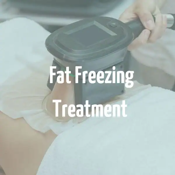 fat freezing treatment Borehamwood