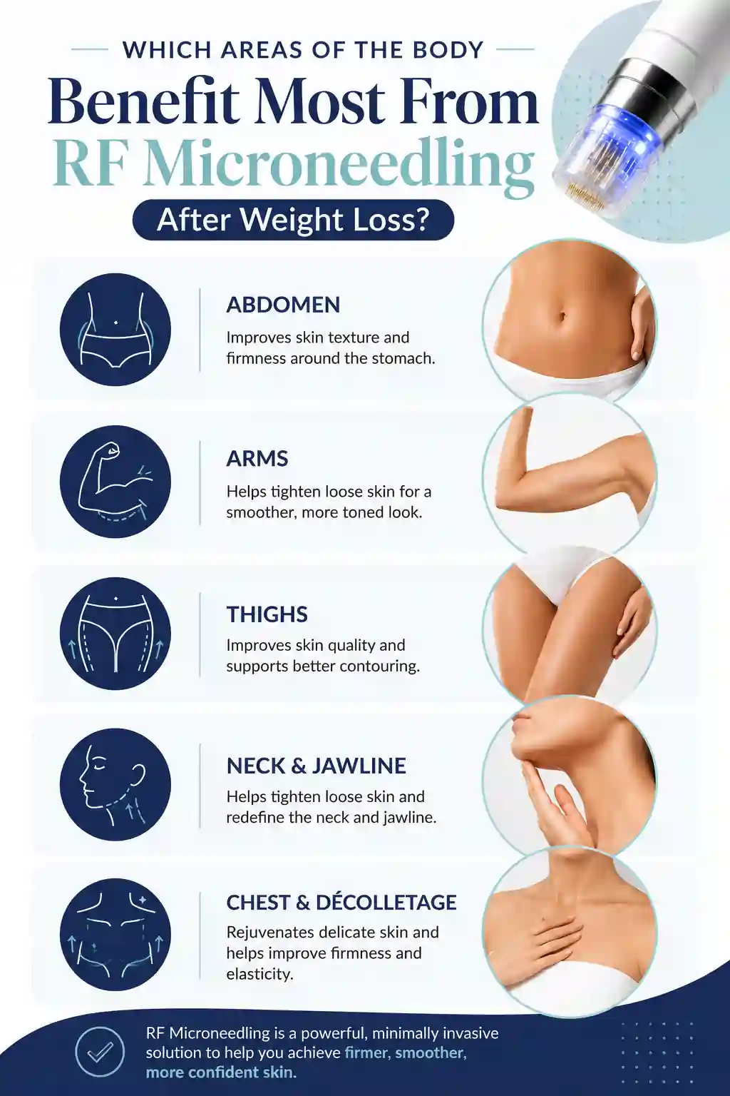 Which Areas of the Body Benefit Most From RF Microneedling After Weight Loss Borehamwood